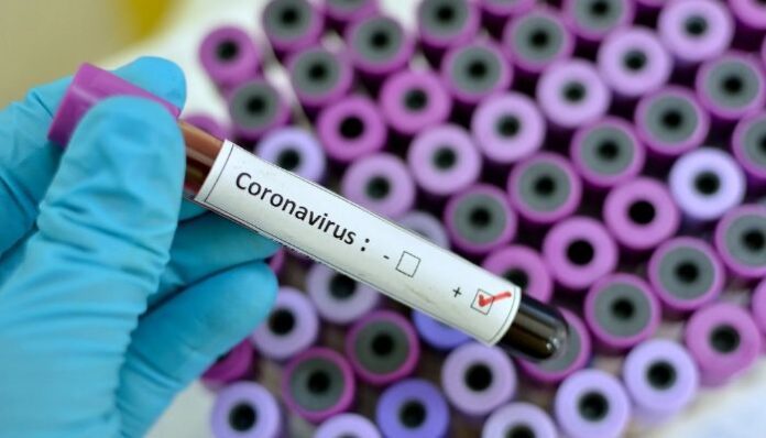 What is Corona Viruses_ What are the Symptoms of Corona Viruses_ (1)