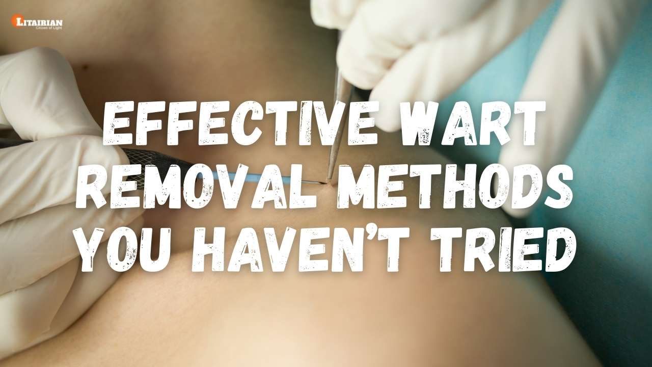 Effective Wart Removal Methods You Haven’t Tried
